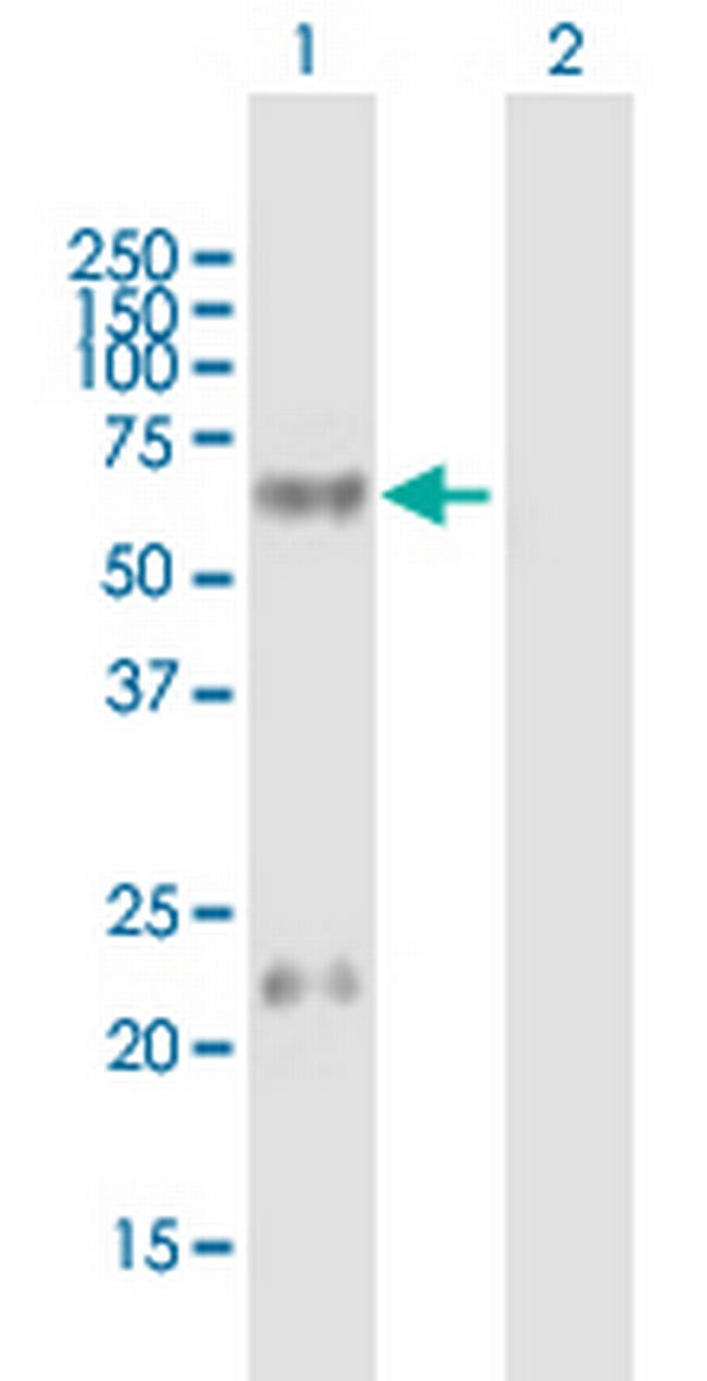 LTBR Antibody in Western Blot (WB)