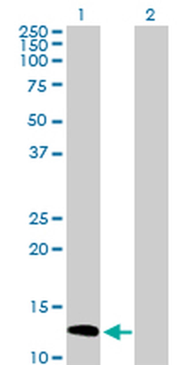 SH2D1A Antibody in Western Blot (WB)