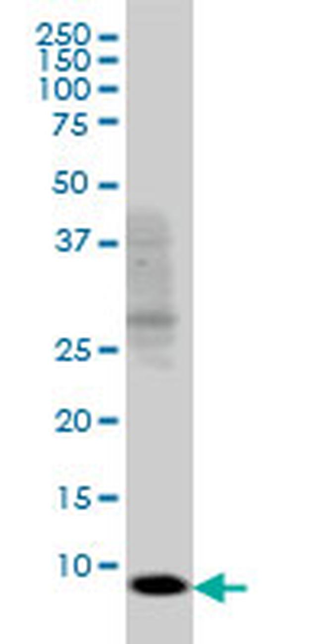 SH2D1A Antibody in Western Blot (WB)