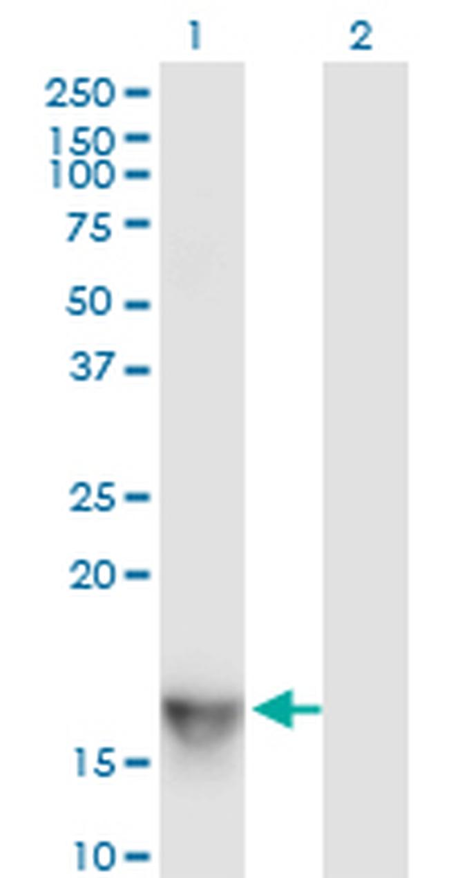 SH2D1A Antibody in Western Blot (WB)