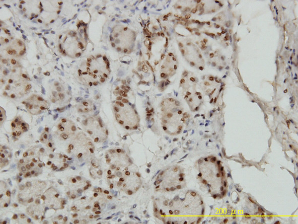 SMAD1 Antibody in Immunohistochemistry (Paraffin) (IHC (P))