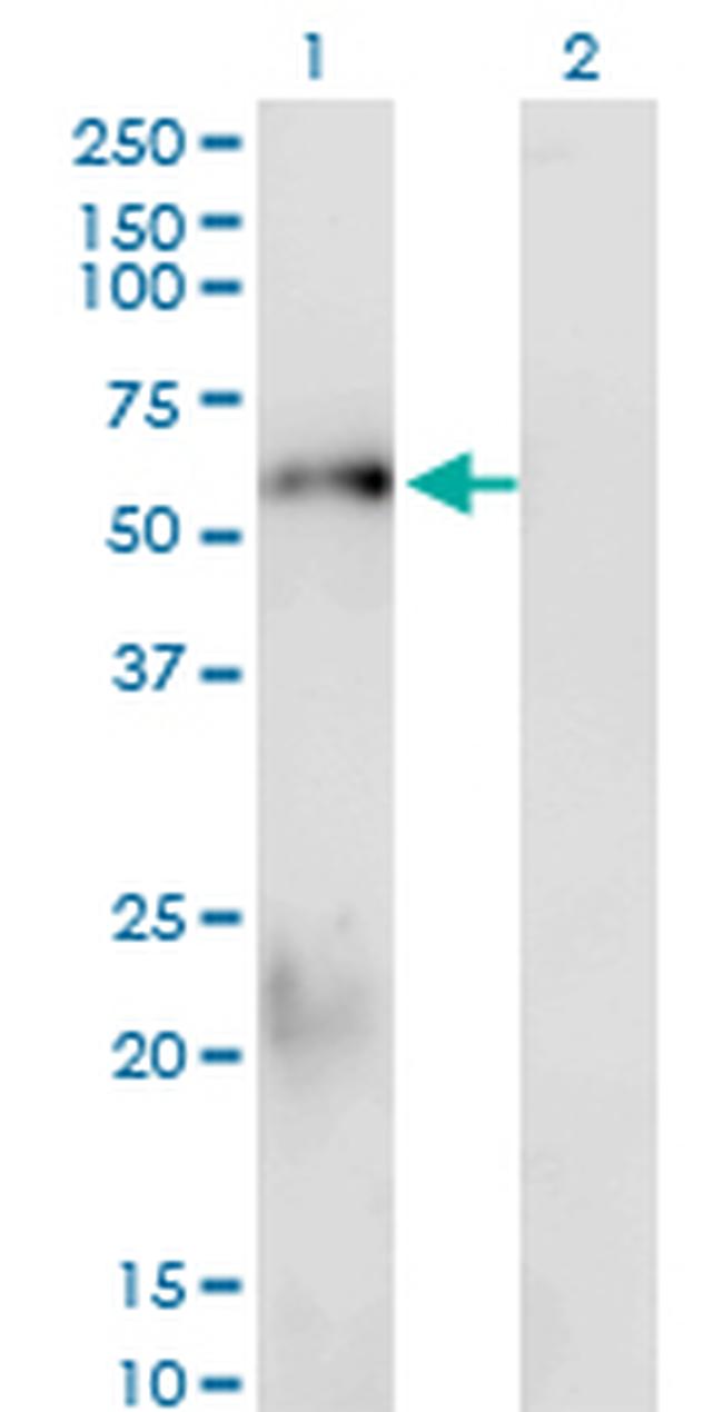 SMAD1 Antibody in Western Blot (WB)