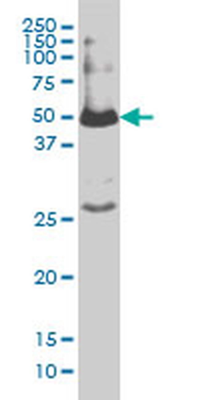 SMAD1 Antibody in Western Blot (WB)