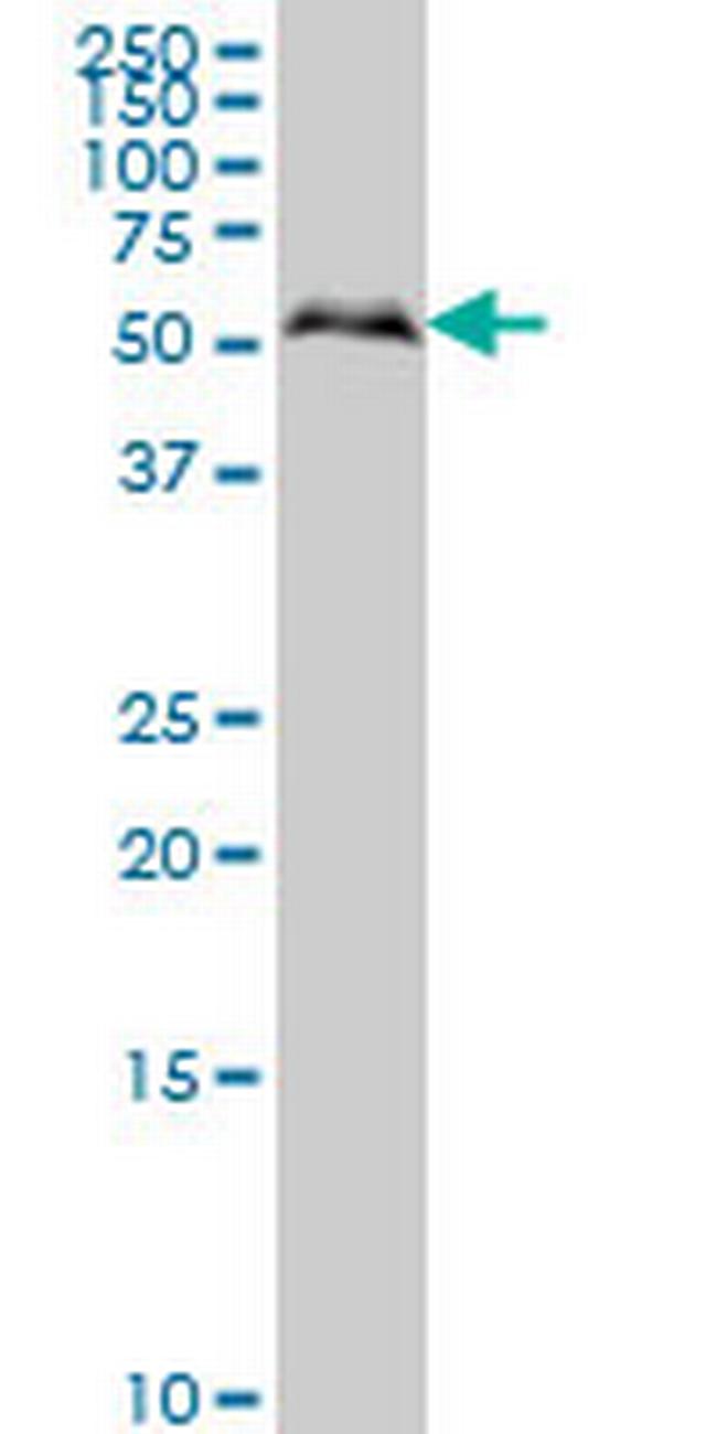 SMAD1 Antibody in Western Blot (WB)