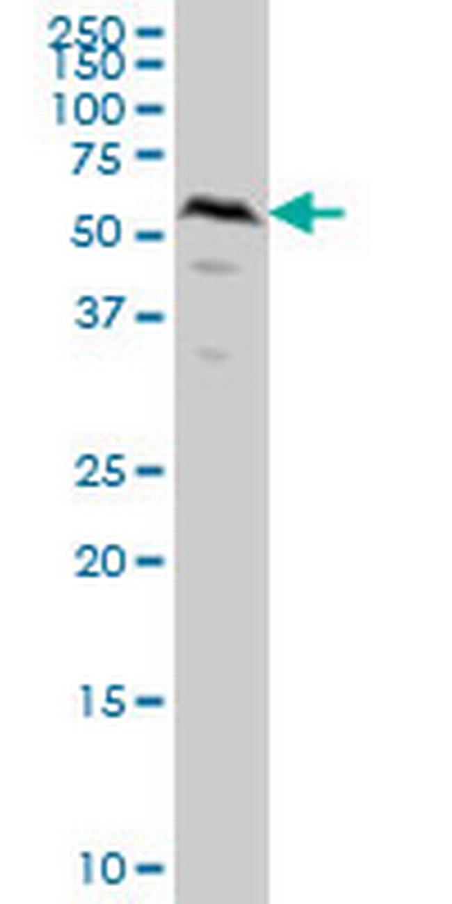 SMAD1 Antibody in Western Blot (WB)