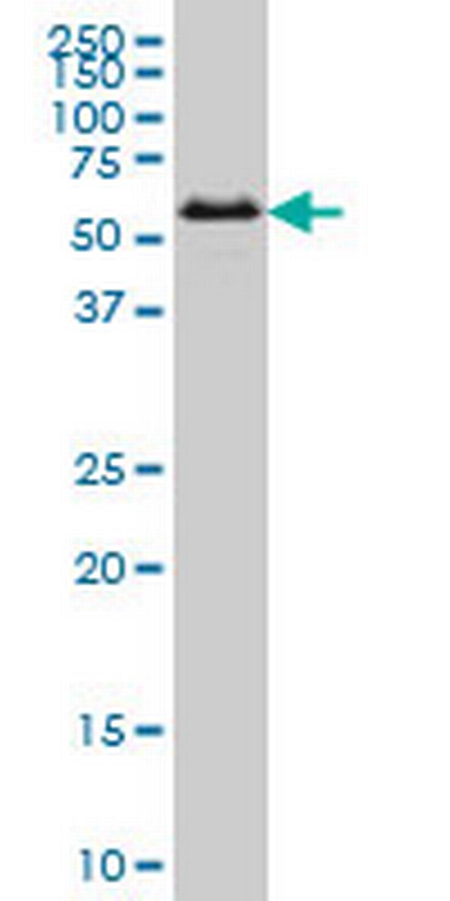 SMAD1 Antibody in Western Blot (WB)