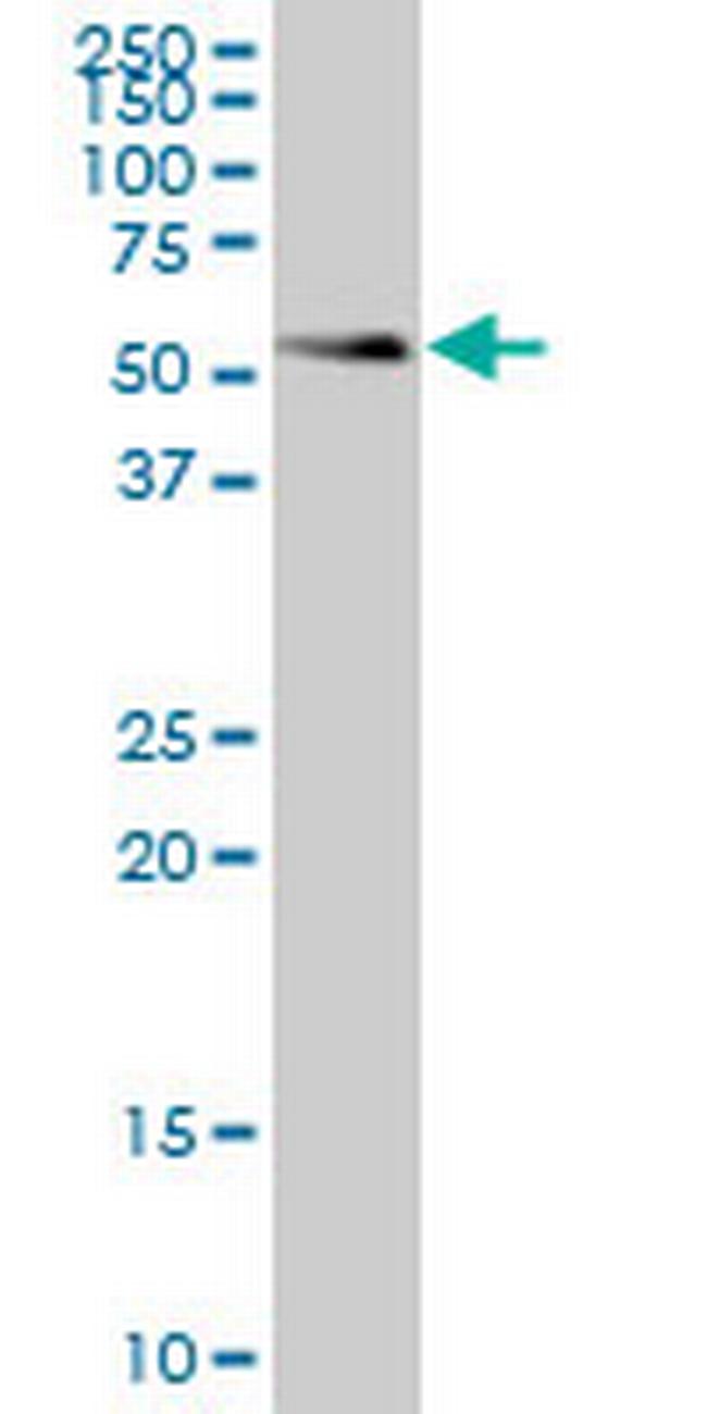 SMAD1 Antibody in Western Blot (WB)