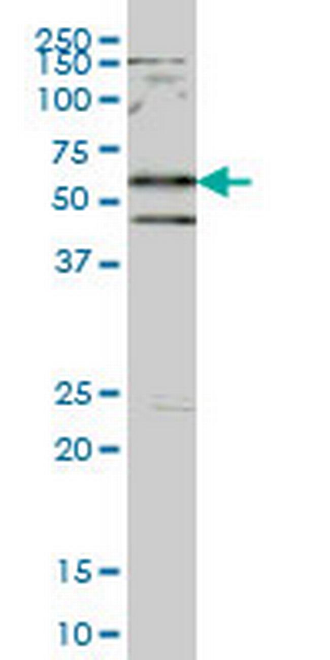 SMAD2 Antibody in Western Blot (WB)