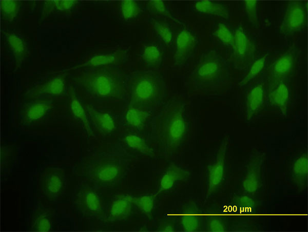 SMAD2 Antibody in Immunocytochemistry (ICC/IF)