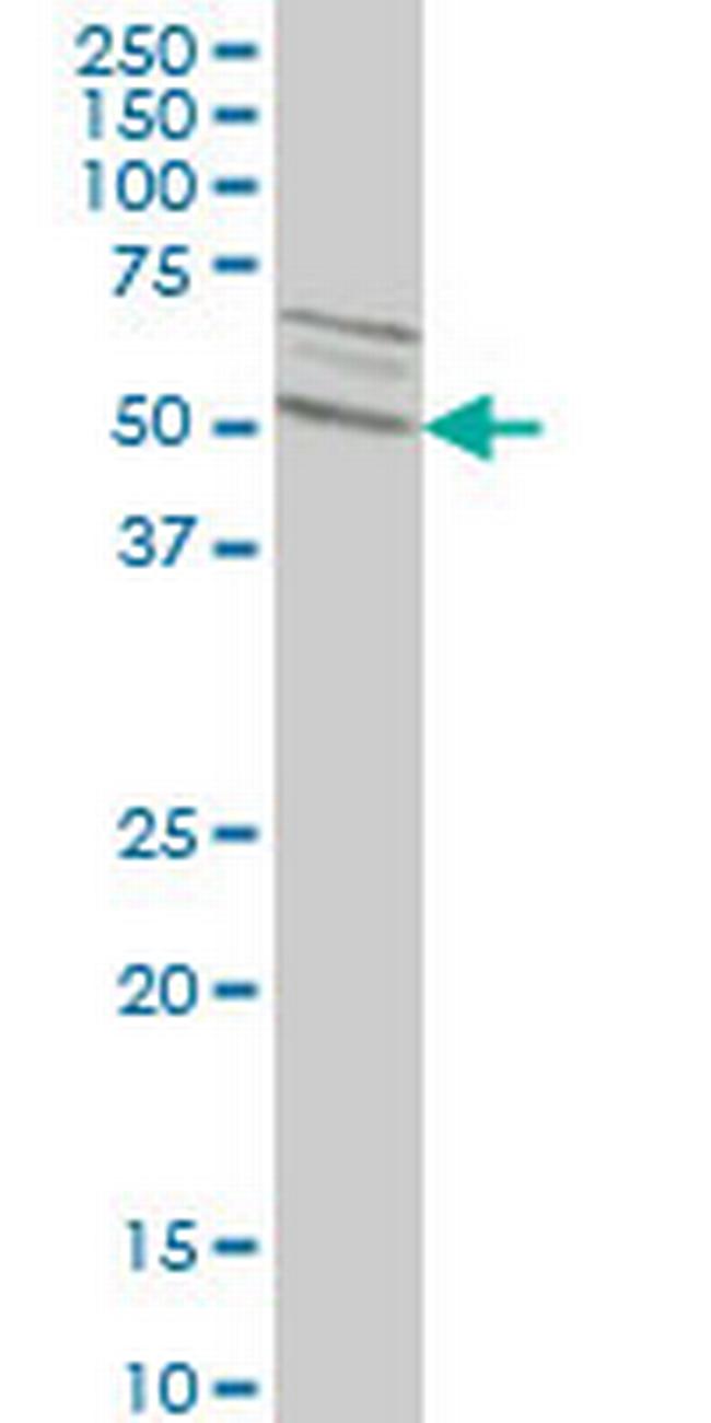 SMAD2 Antibody in Western Blot (WB)