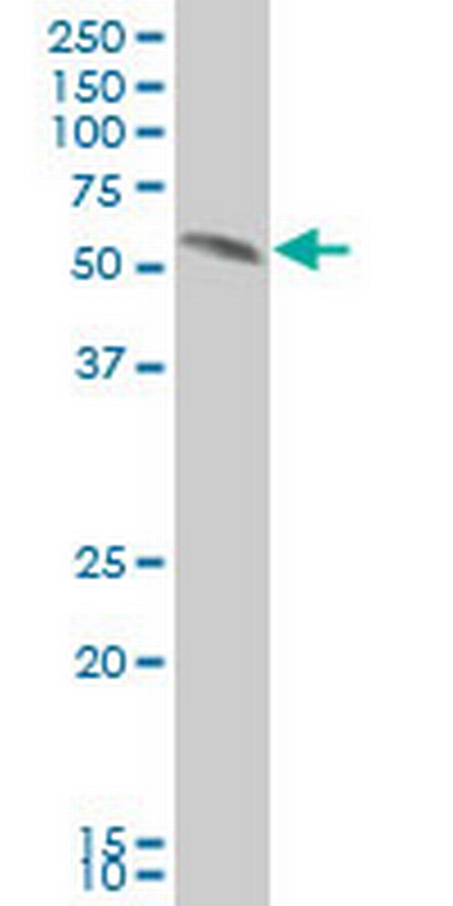 SMAD2 Antibody in Western Blot (WB)