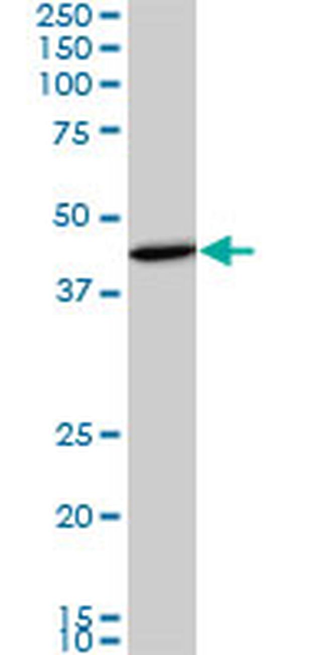 SMAD3 Antibody in Western Blot (WB)