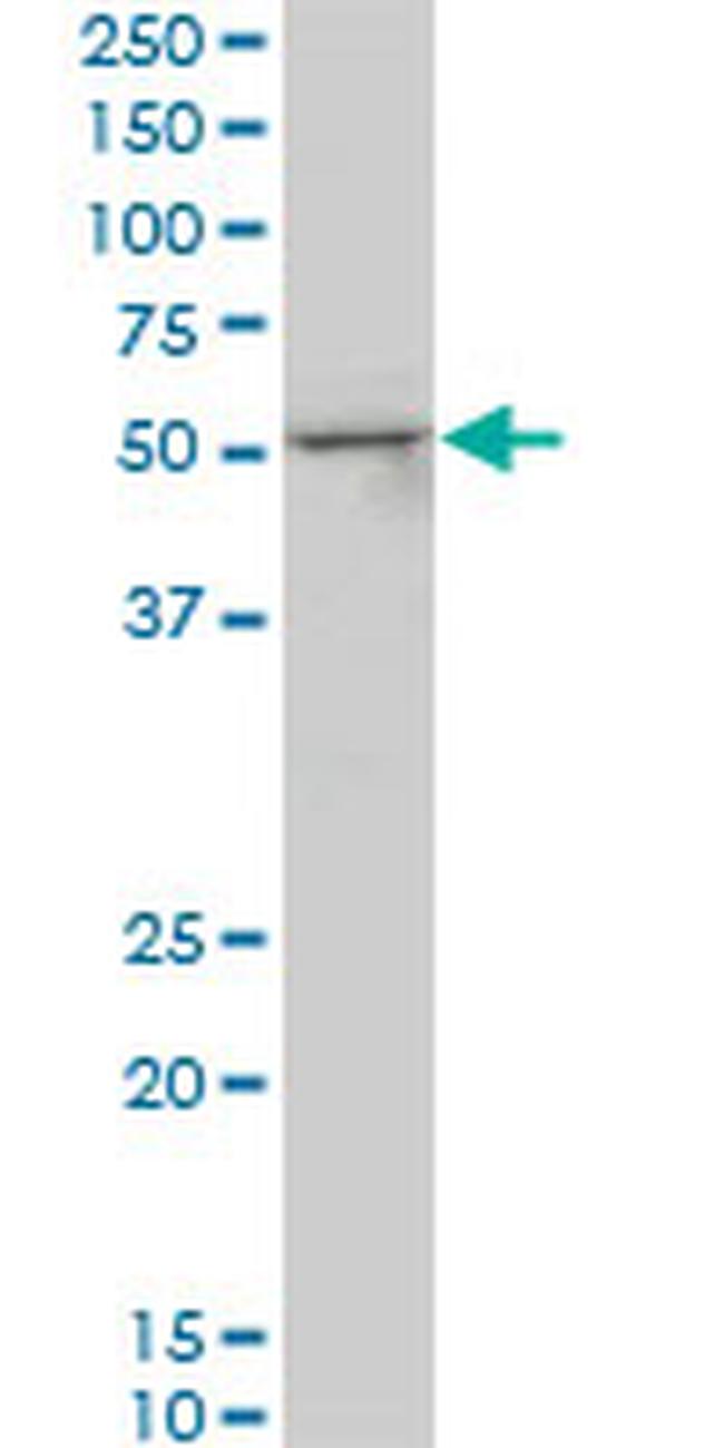 SMAD3 Antibody in Western Blot (WB)