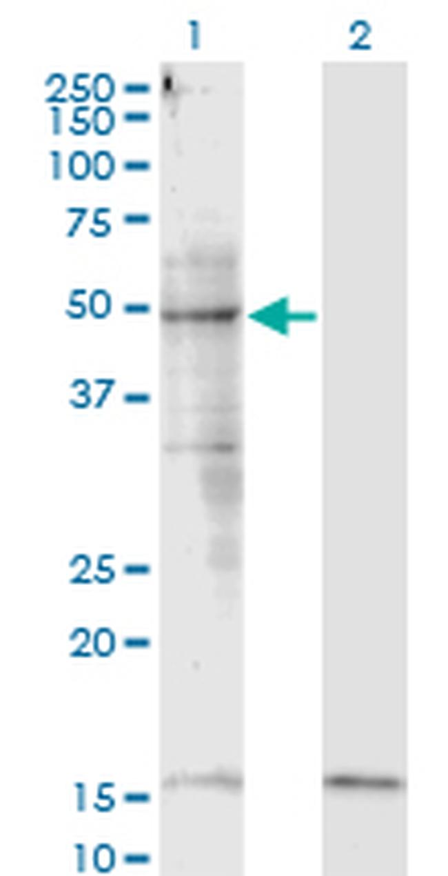 SMAD3 Antibody in Western Blot (WB)