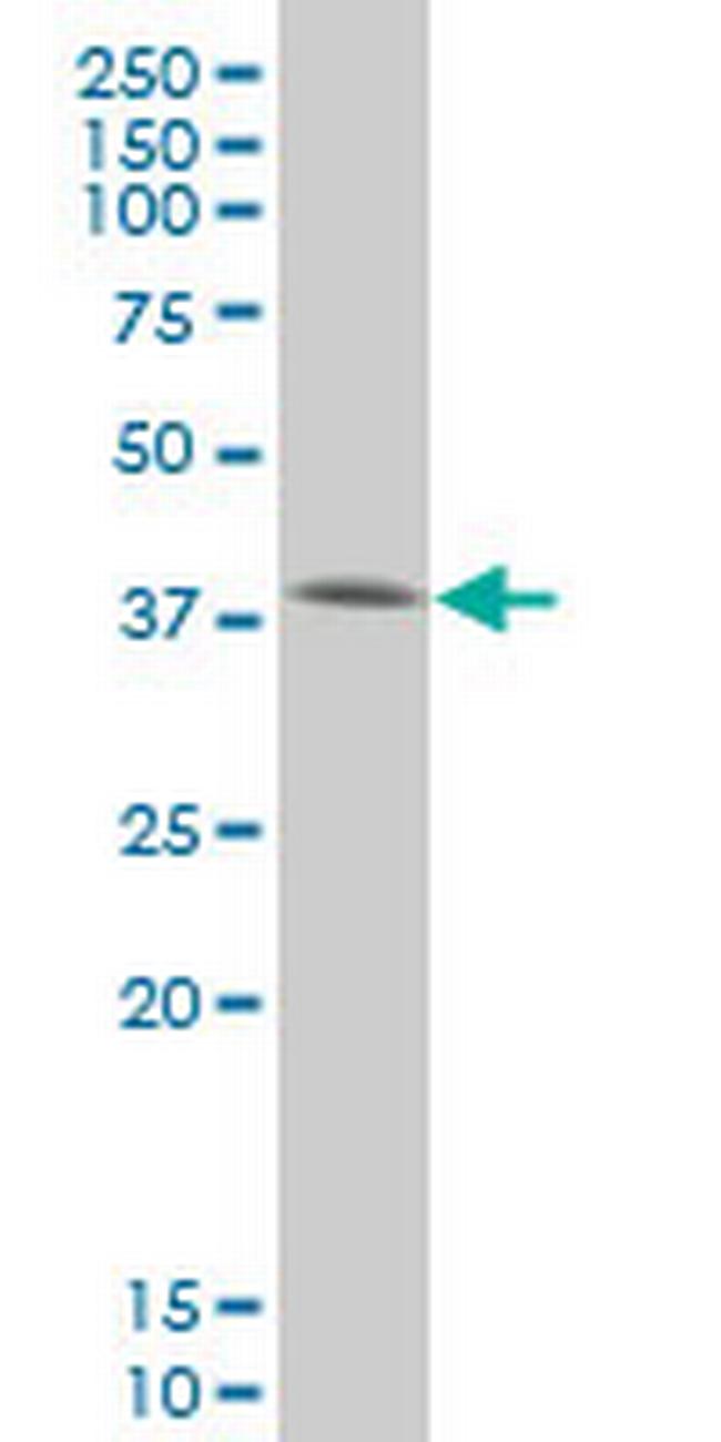 SMAD3 Antibody in Western Blot (WB)