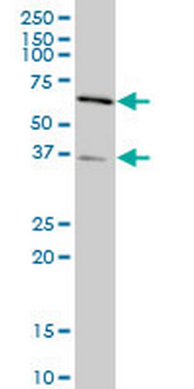 SMAD3 Antibody in Western Blot (WB)