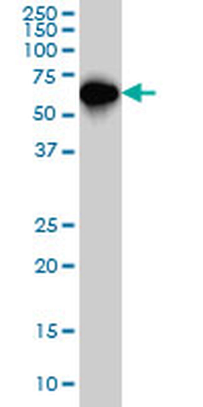 SMAD4 Antibody in Western Blot (WB)