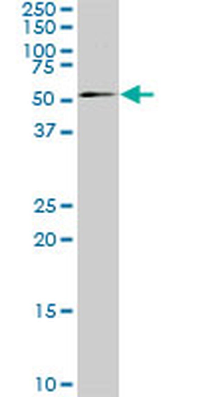 SMAD4 Antibody in Western Blot (WB)