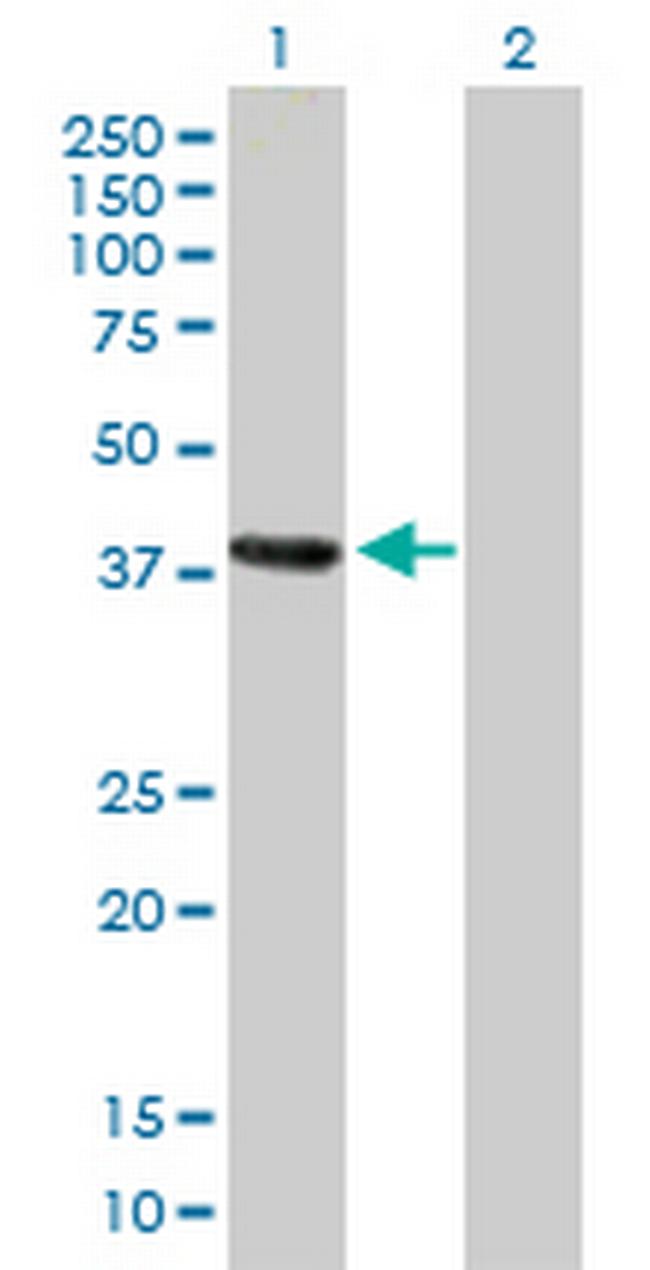 MAGEA4 Antibody in Western Blot (WB)