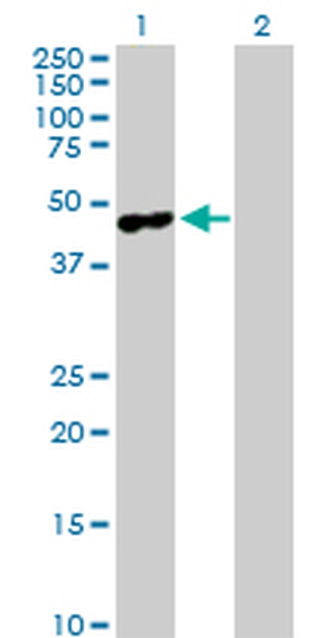 MAGEA4 Antibody in Western Blot (WB)