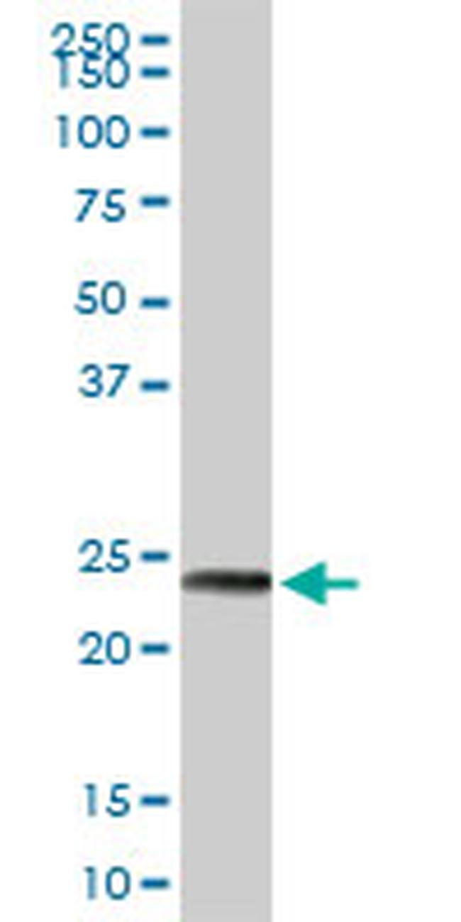 MAGEA8 Antibody in Western Blot (WB)