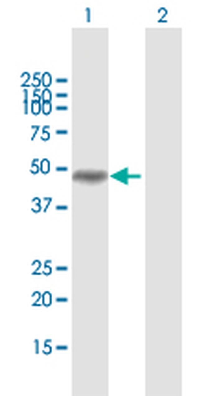 MAGEA8 Antibody in Western Blot (WB)