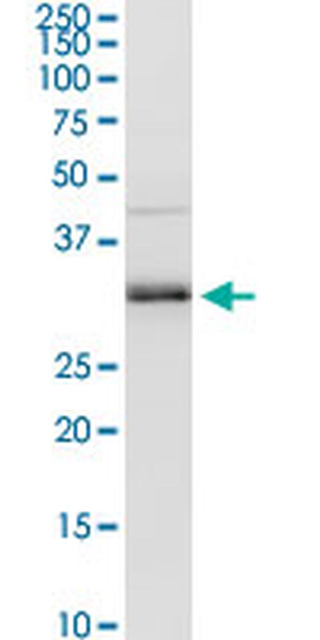 MAGEA9 Antibody in Western Blot (WB)