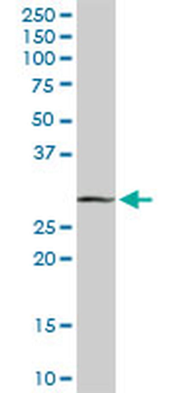 MAGEA9 Antibody in Western Blot (WB)