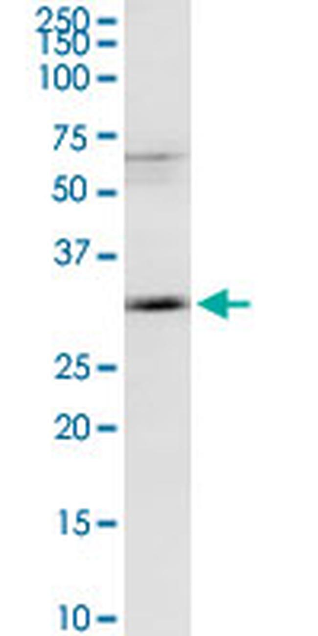 MAGEA9 Antibody in Western Blot (WB)