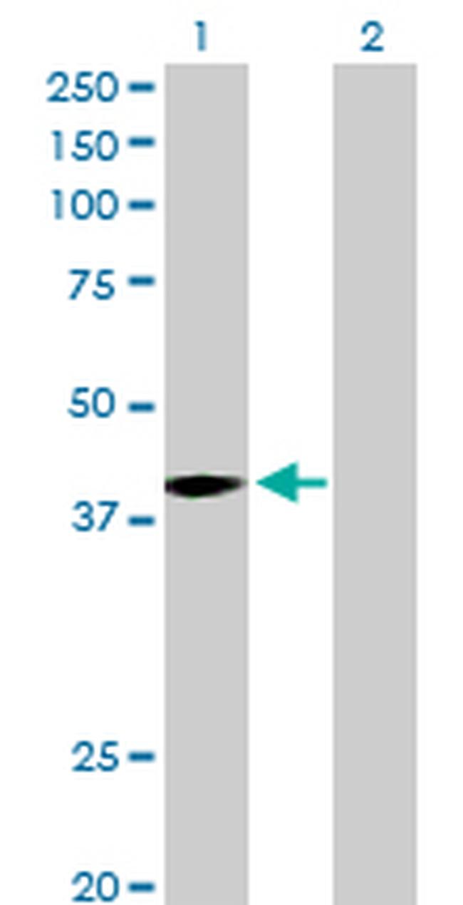 MAGEA9 Antibody in Western Blot (WB)