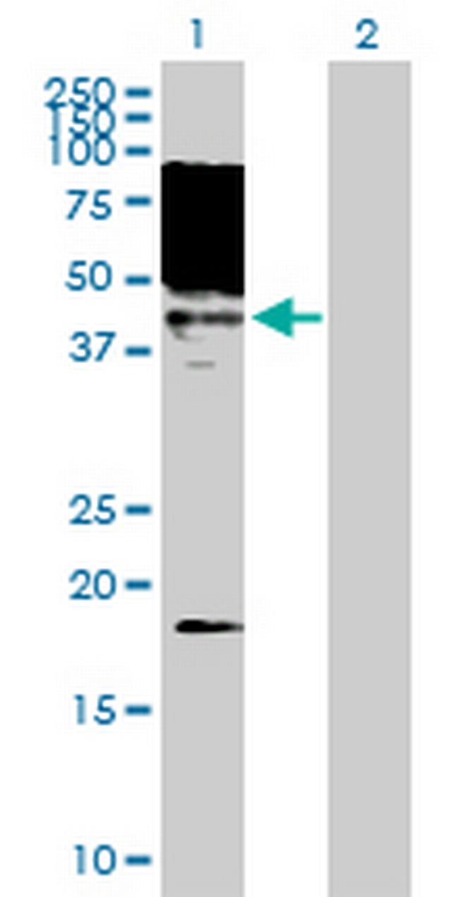 MAGEA10 Antibody in Western Blot (WB)