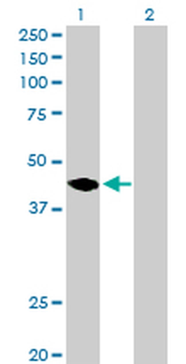 MAGEA11 Antibody in Western Blot (WB)