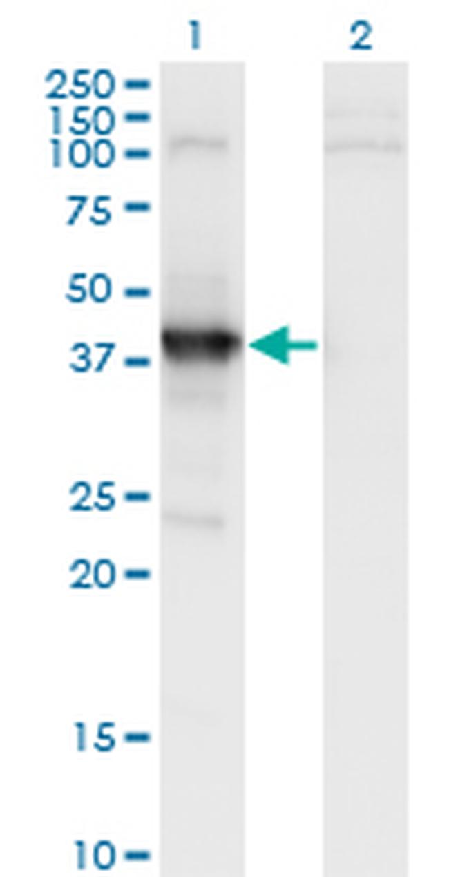MAGEA11 Antibody in Western Blot (WB)