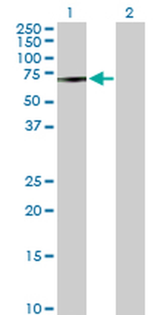 MAK Antibody in Western Blot (WB)