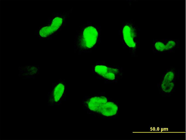 MAK Antibody in Immunocytochemistry (ICC/IF)