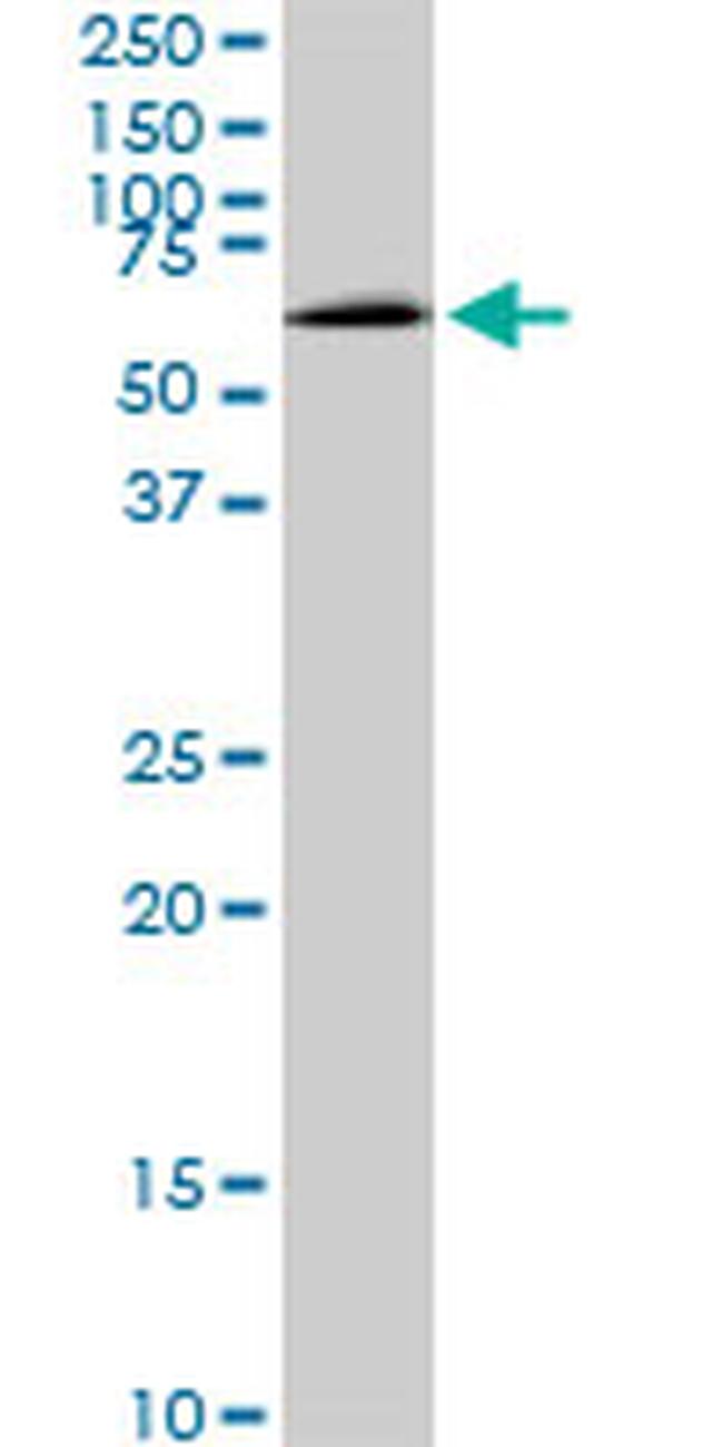 MAK Antibody in Western Blot (WB)