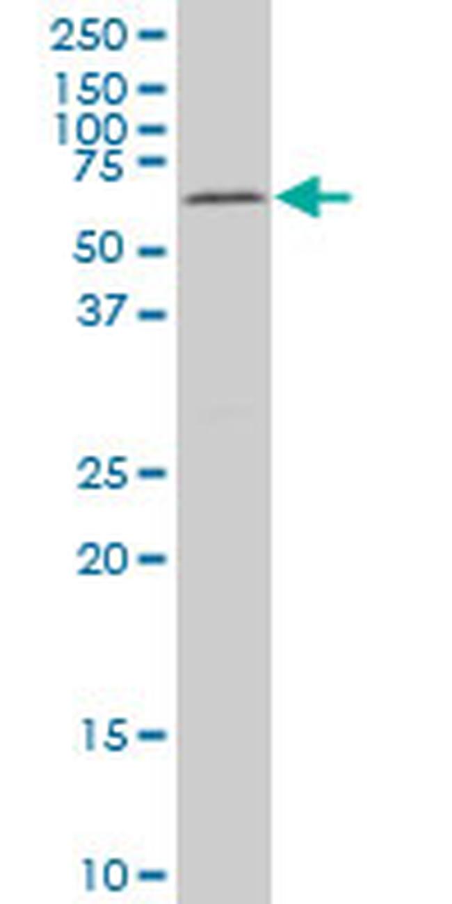 MAK Antibody in Western Blot (WB)