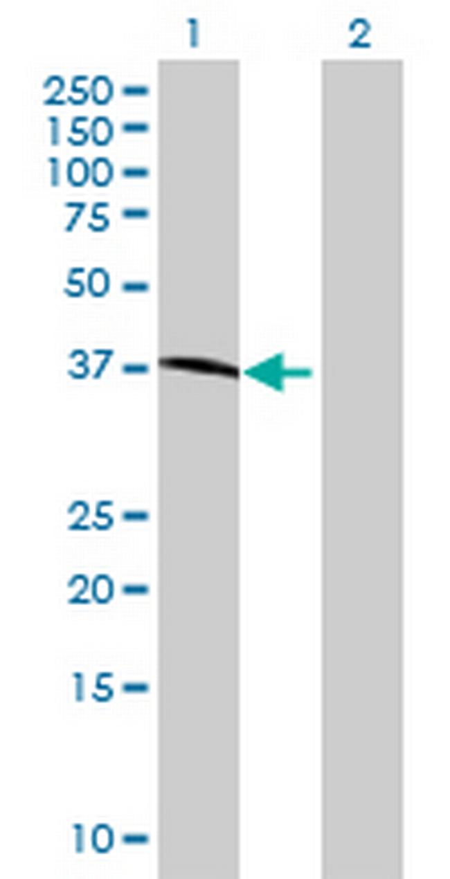 MAN1A1 Antibody in Western Blot (WB)