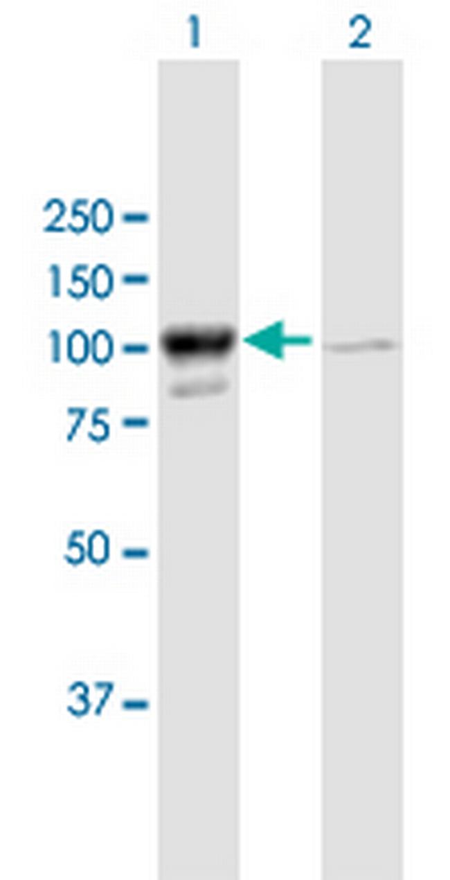 MARS Antibody in Western Blot (WB)