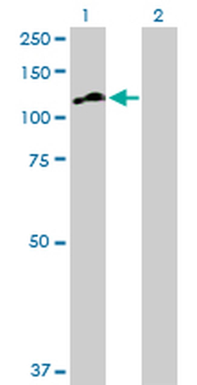 MATN2 Antibody in Western Blot (WB)