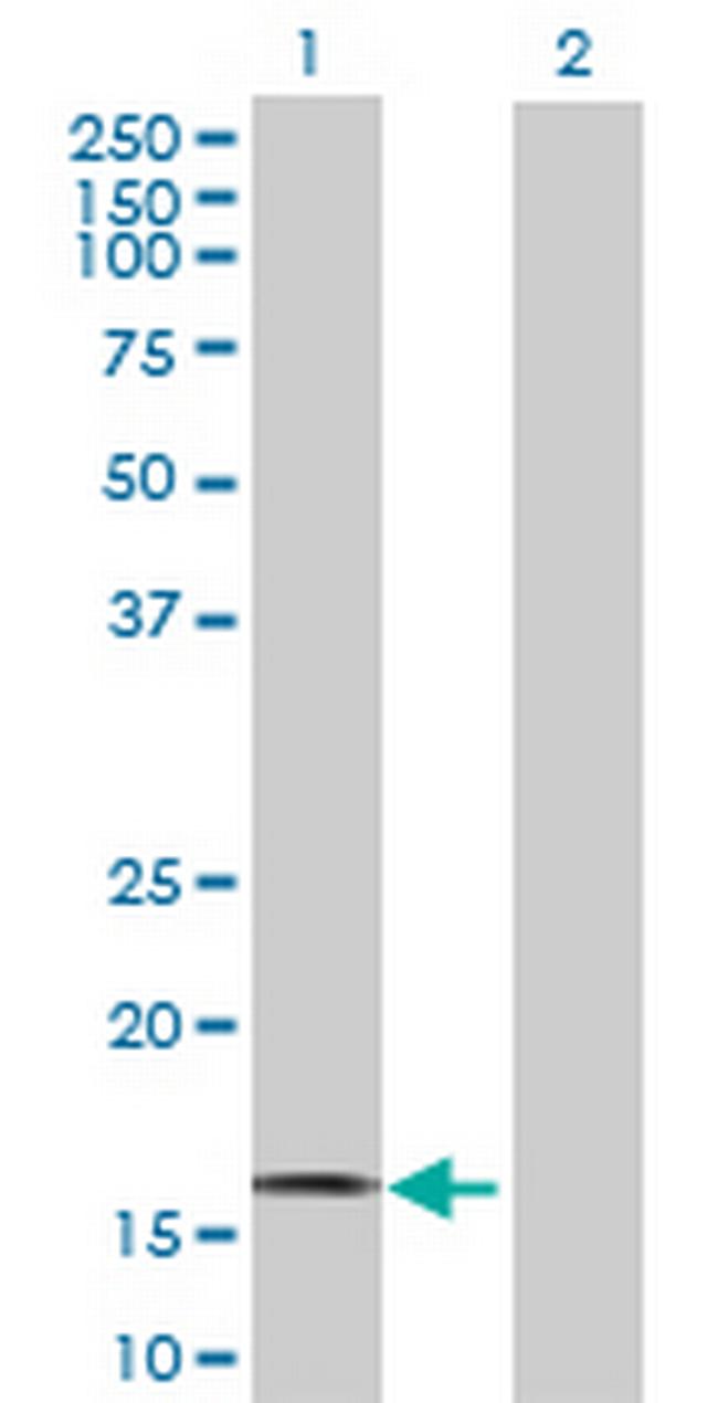 MB Antibody in Western Blot (WB)