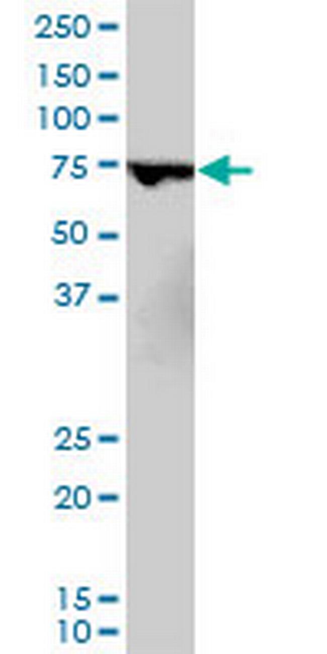 MBD1 Antibody in Western Blot (WB)