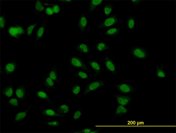 MBNL1 Antibody in Immunocytochemistry (ICC/IF)