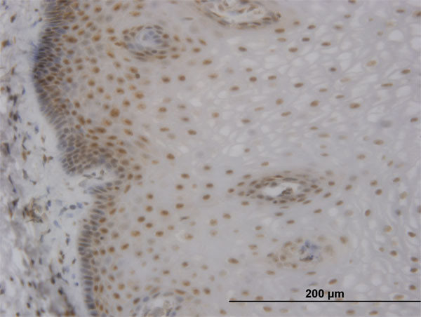 MBNL1 Antibody in Immunohistochemistry (Paraffin) (IHC (P))