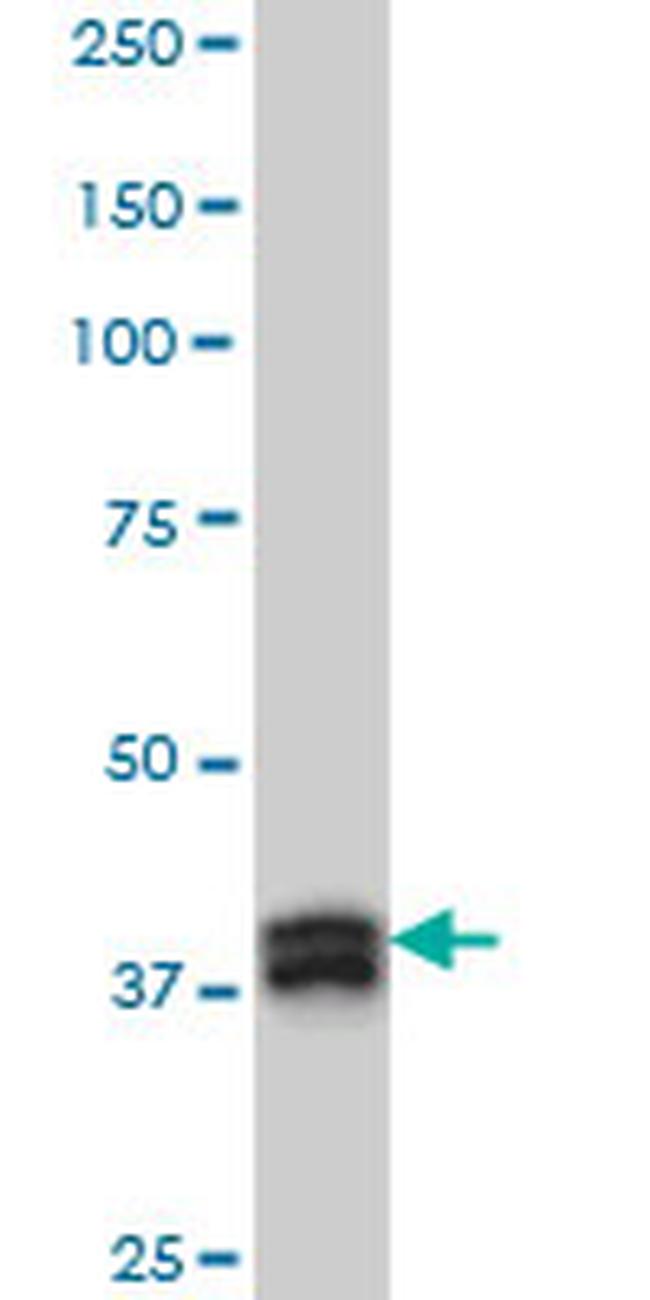 MBNL1 Antibody in Western Blot (WB)