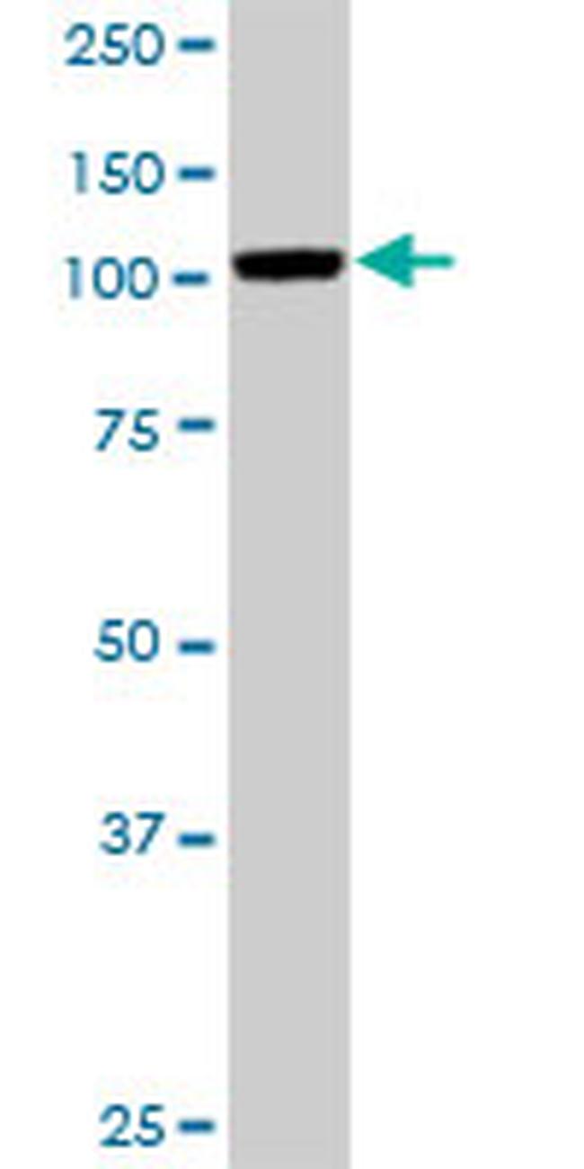 MCC Antibody in Western Blot (WB)