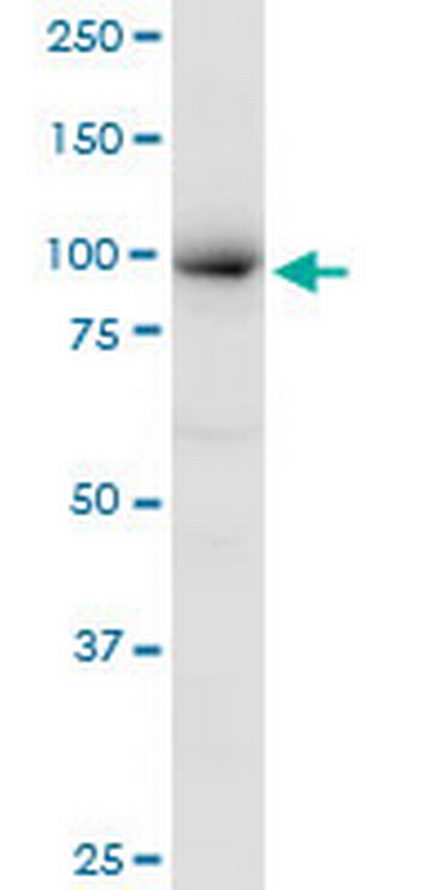 MCM4 Antibody in Western Blot (WB)