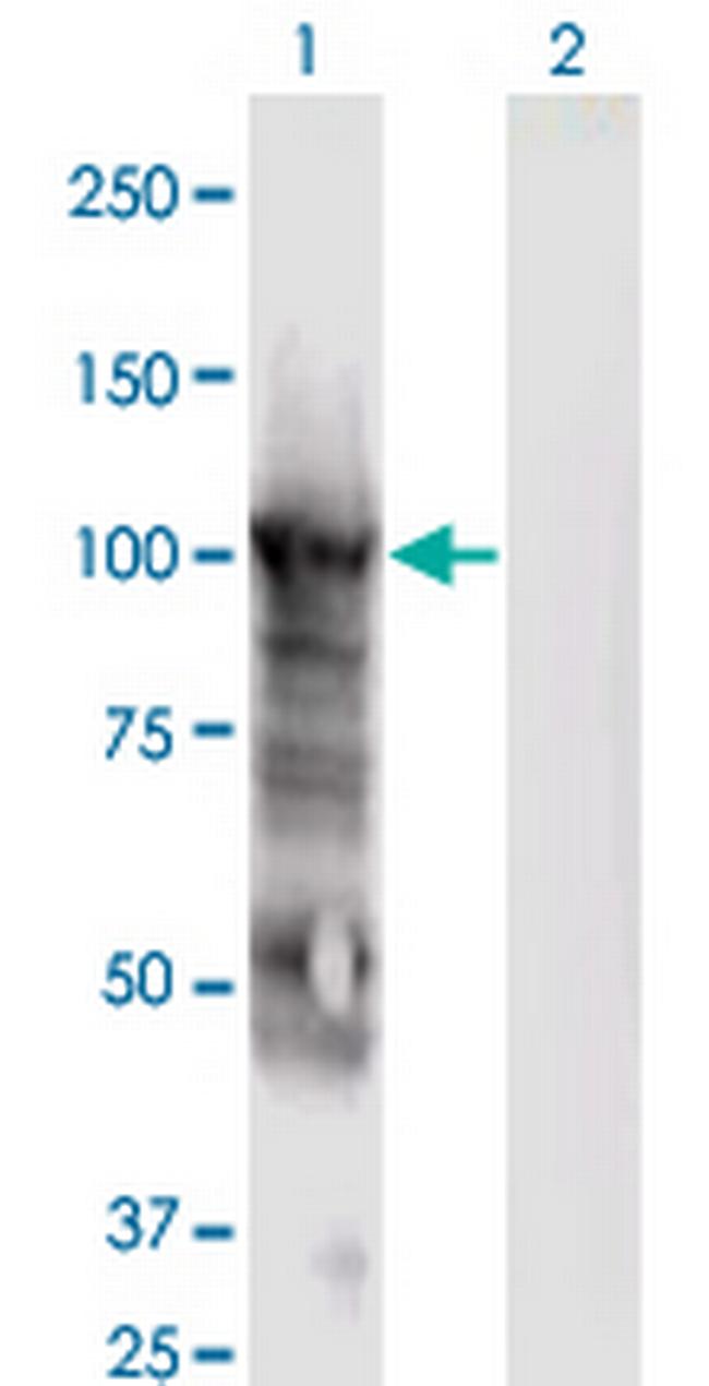 MCM6 Antibody in Western Blot (WB)