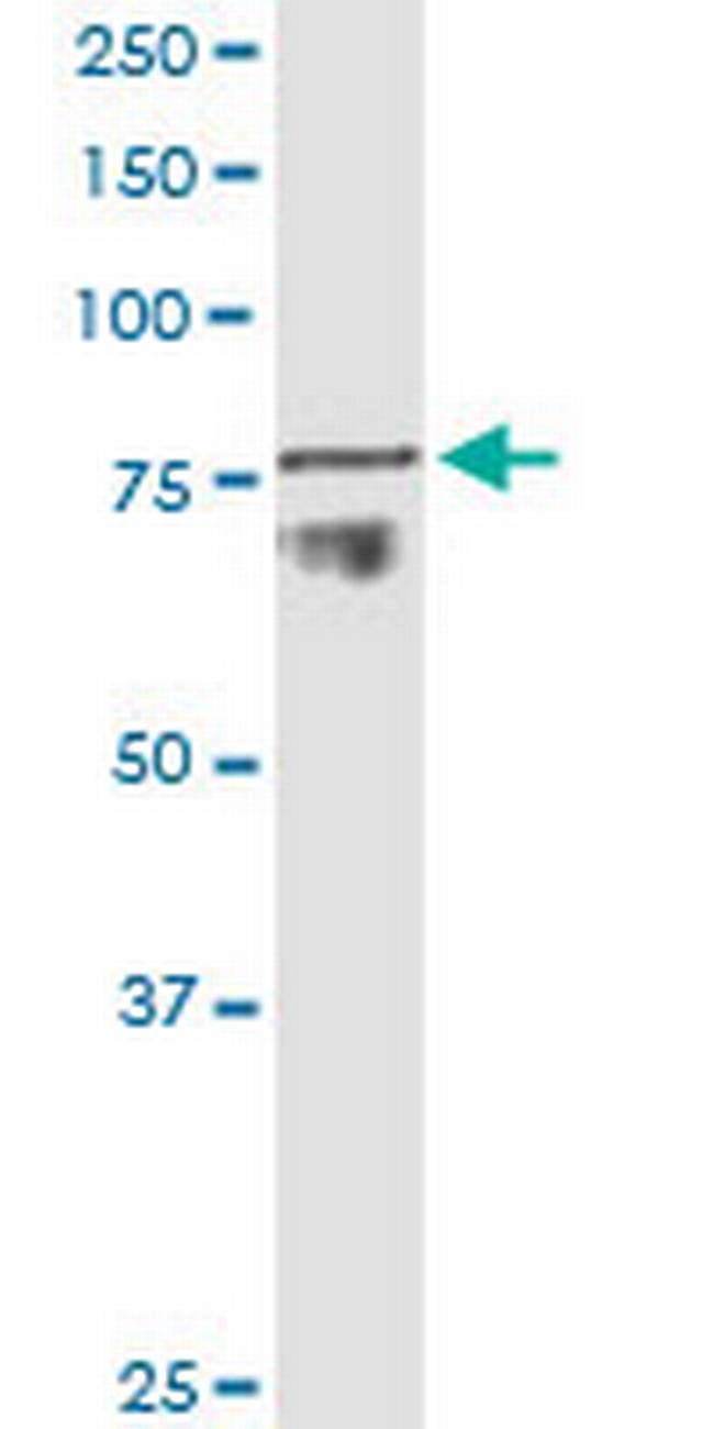 ADAM11 Antibody in Western Blot (WB)