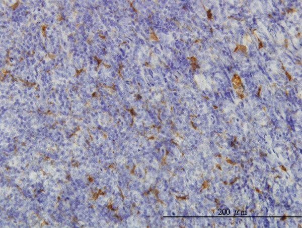 ME1 Antibody in Immunohistochemistry (Paraffin) (IHC (P))